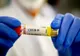 Coronavirus 1 martie: 2.096 cazuri noi şi 53 decese
